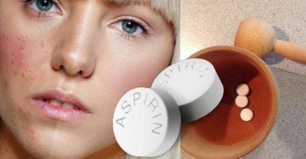 aspirin-lice