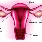 Endometriosis1-500x325