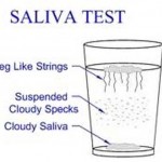 Saliva_Candida_Test