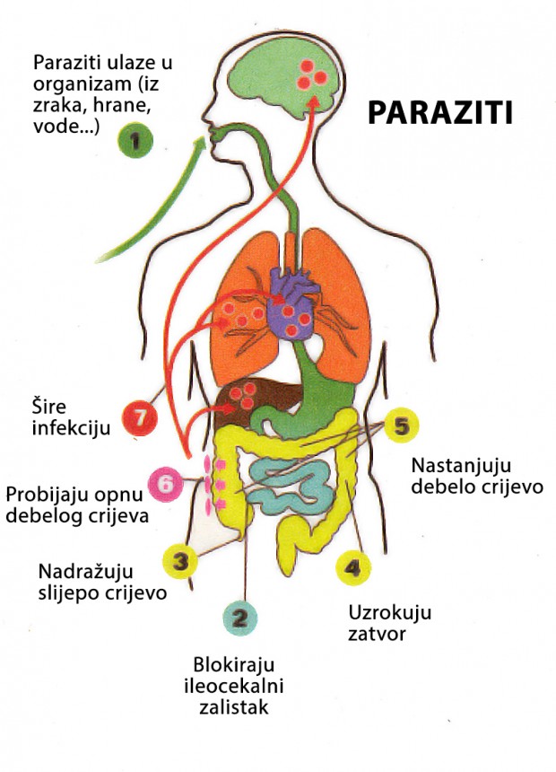paraziti