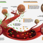 tumor-stanice