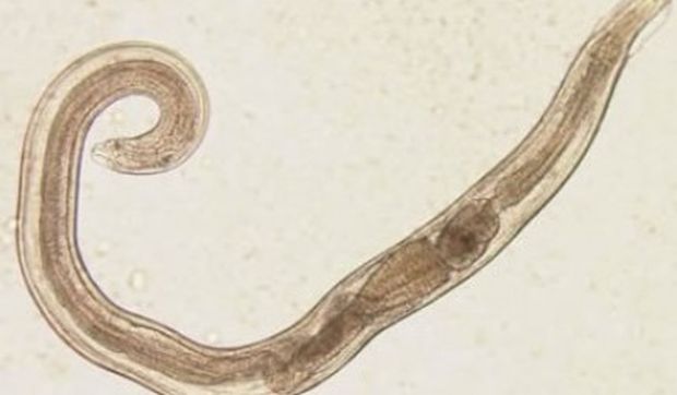 crijevni-parazit