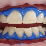 bez-odlaska-zubaru