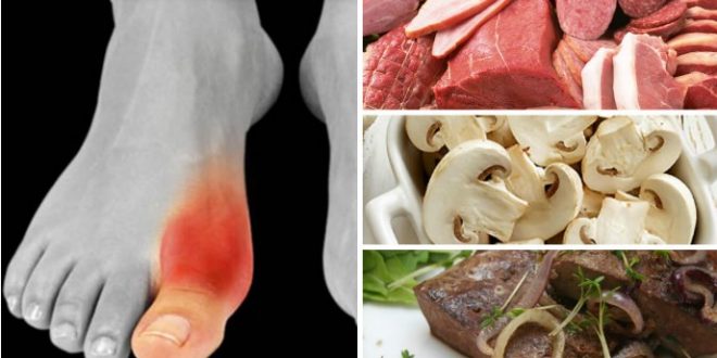 Bolujete li od artritisa, ovih 11 namirnica izbacite iz prehrane - bloodlust-uk.com
