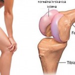 kako-obnoviti-hrskavicu-kolena