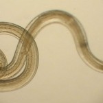 crijevni-paraziti-gliste