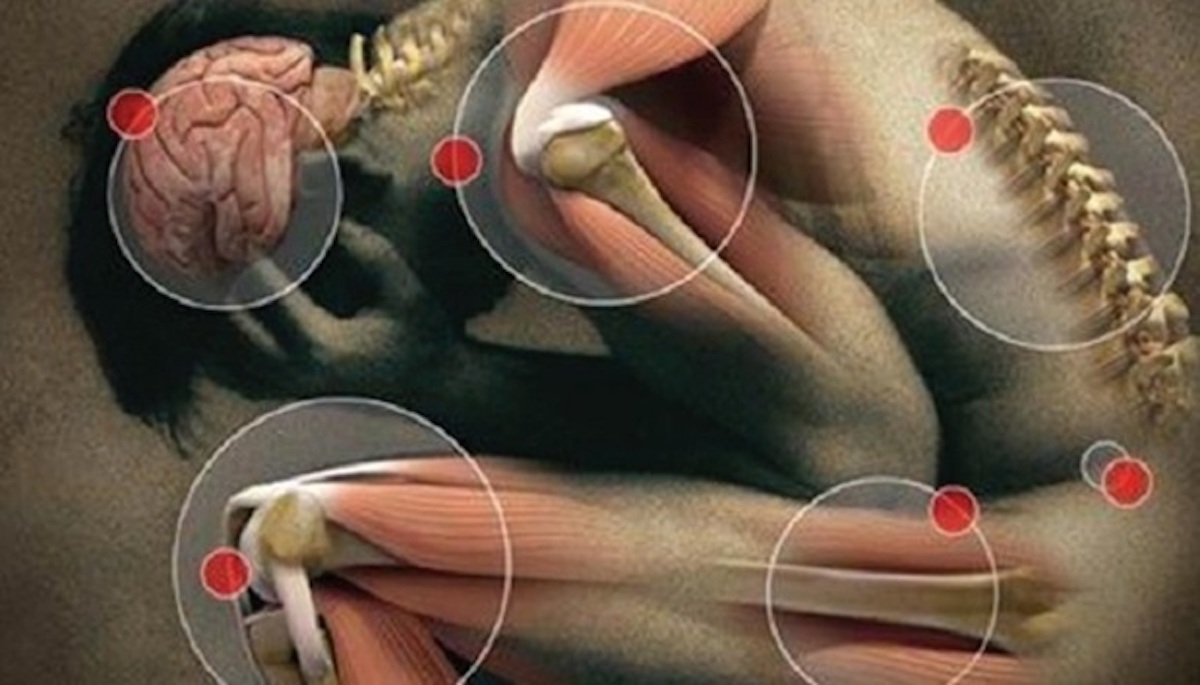artroza ramenog zgloba i njegovo liječenje čučnjevi bol u zglobu kuka