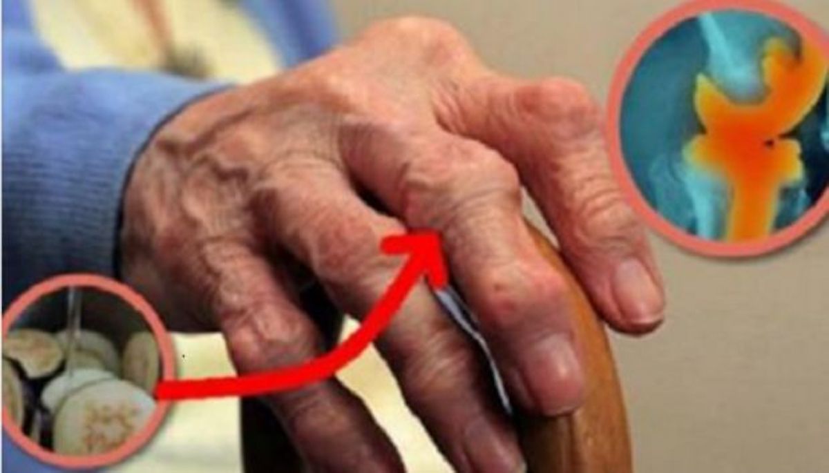 gel za bol u lakatnom zglobu artritis artroza ruku simptomi liječenje