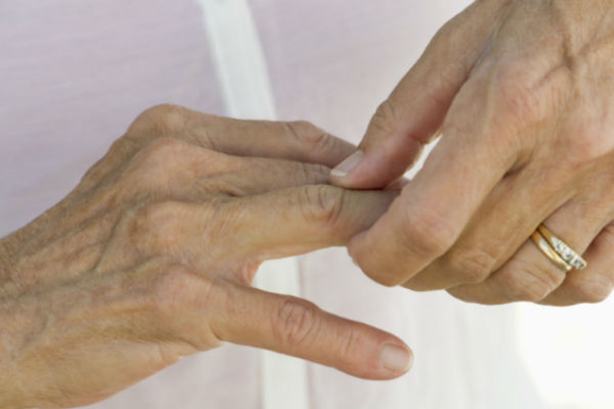 artritis-ruke