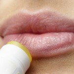 Prirodni lijekovi za herpes na usni – Ova 3 kućna lijeka koji “brišu” sve herpese